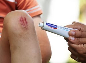 vaseline op wond na operatie